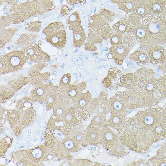 Glutamine Synthetase Antibody in Immunohistochemistry (Paraffin) (IHC (P))