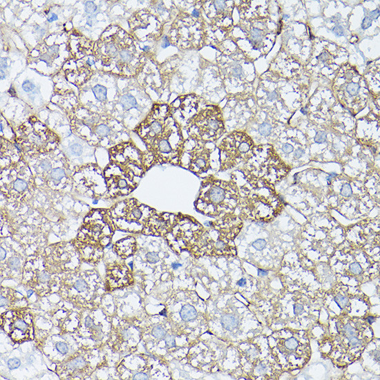 Glutamine Synthetase Antibody in Immunohistochemistry (Paraffin) (IHC (P))