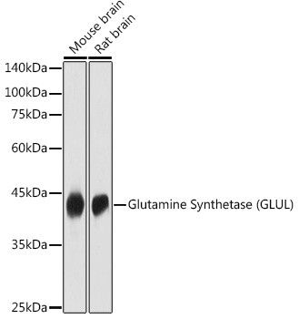 Glutamine Synthetase Antibody in Western Blot (WB)