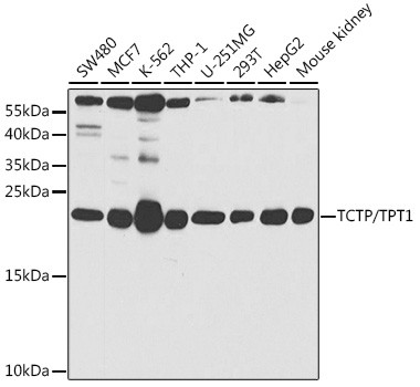 TPT1 Antibody in Western Blot (WB)