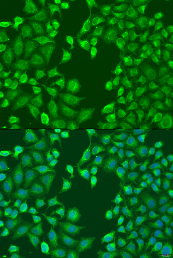 MERTK Antibody in Immunocytochemistry (ICC/IF)