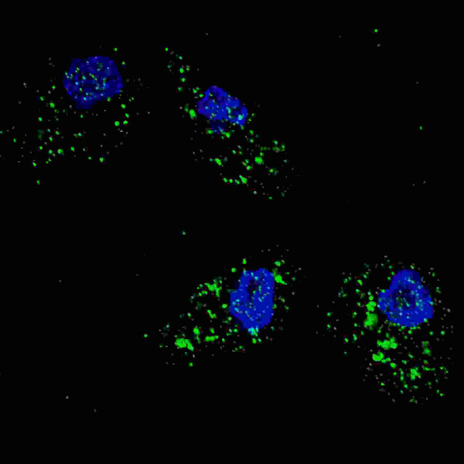 SQSTM1 Antibody in Immunocytochemistry (ICC/IF)