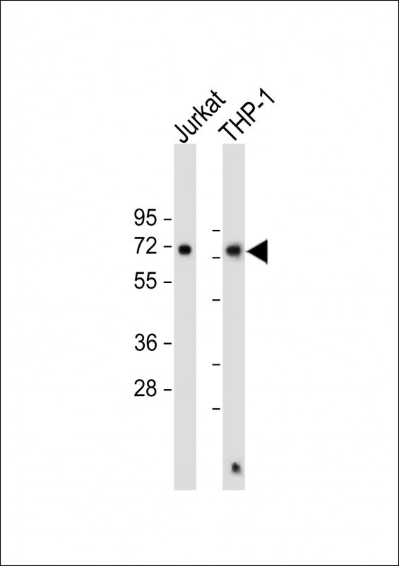 SQSTM1 Antibody in Western Blot (WB)