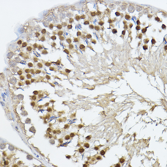 PRDM14 Antibody in Immunohistochemistry (Paraffin) (IHC (P))