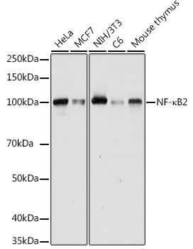 NFkB p52/p100 Antibody in Western Blot (WB)