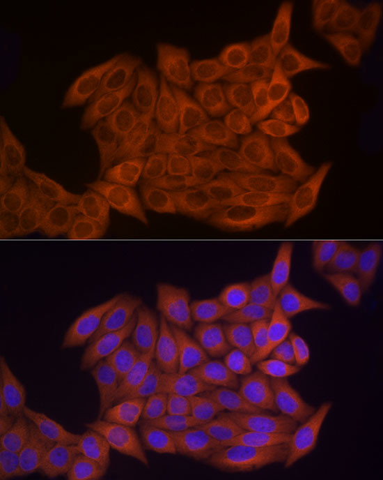 TK1 Antibody in Immunocytochemistry (ICC/IF)