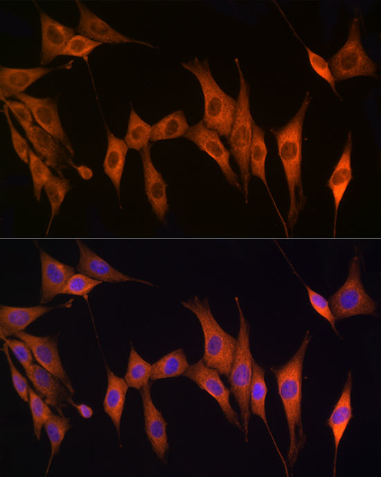 TK1 Antibody in Immunocytochemistry (ICC/IF)