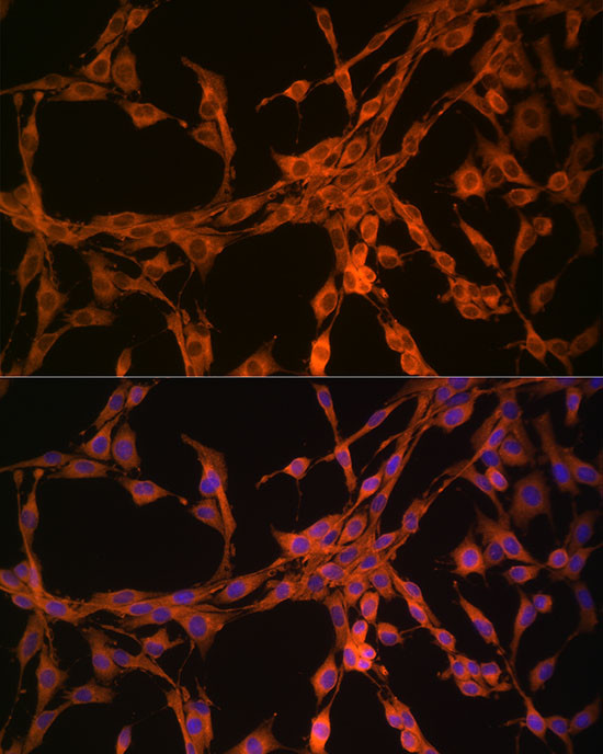 TK1 Antibody in Immunocytochemistry (ICC/IF)