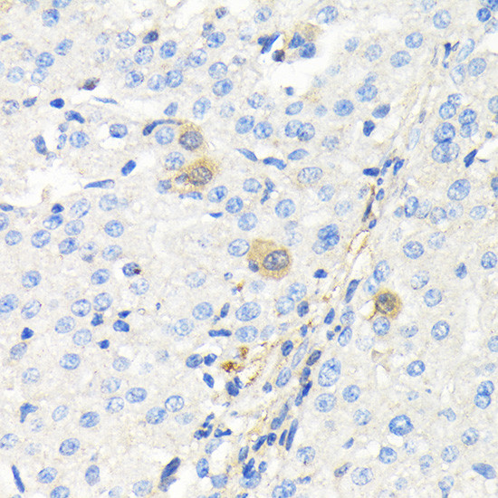 TK1 Antibody in Immunohistochemistry (Paraffin) (IHC (P))