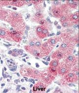 HRD1 Antibody in Immunohistochemistry (Paraffin) (IHC (P))