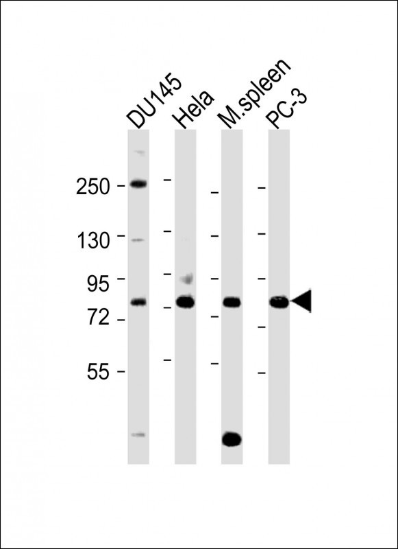 HRD1 Antibody in Western Blot (WB)