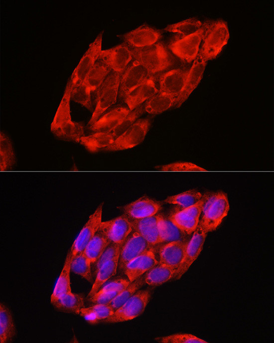 DDX3 Antibody in Immunocytochemistry (ICC/IF)