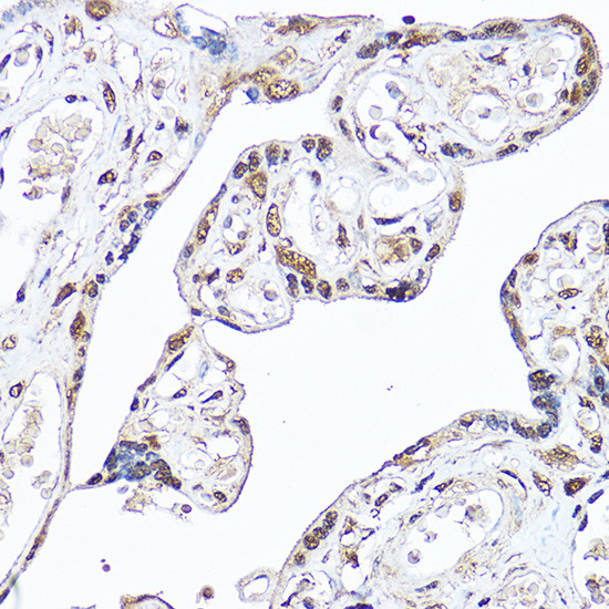 DDX3 Antibody in Immunohistochemistry (Paraffin) (IHC (P))