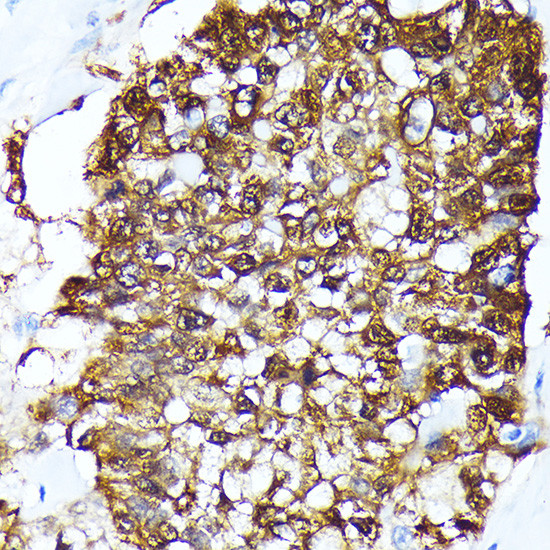 FKBP4 Antibody in Immunohistochemistry (Paraffin) (IHC (P))