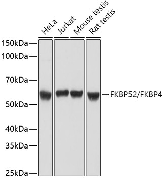 FKBP4 Antibody in Western Blot (WB)