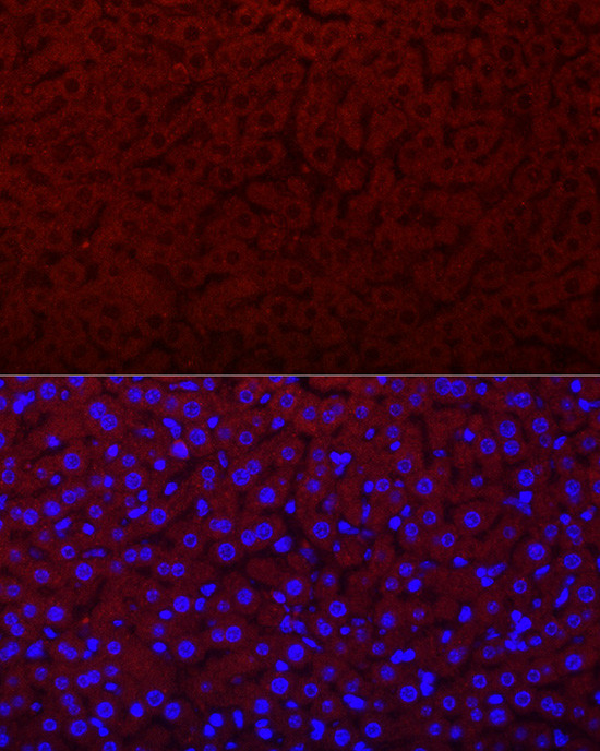 Epo Antibody in Immunocytochemistry (ICC/IF)