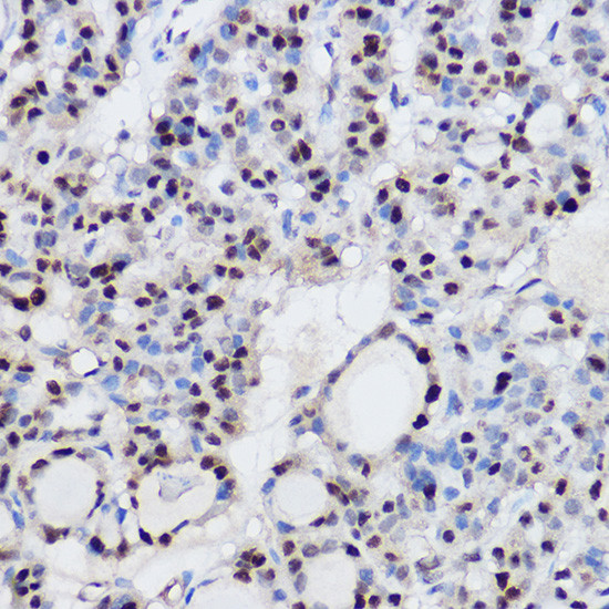 EZH2 Antibody in Immunohistochemistry (Paraffin) (IHC (P))