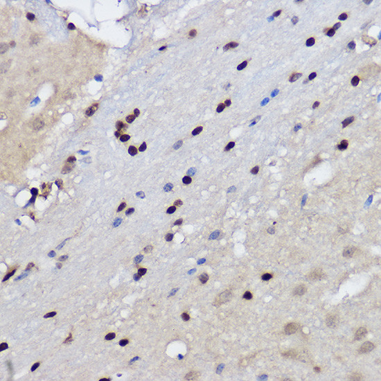 EZH2 Antibody in Immunohistochemistry (Paraffin) (IHC (P))