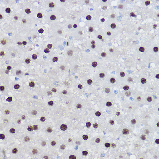 EZH2 Antibody in Immunohistochemistry (Paraffin) (IHC (P))