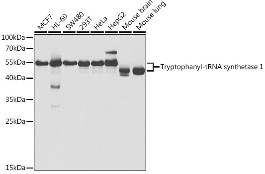 WARS Antibody in Western Blot (WB)