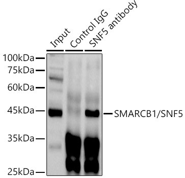 SMARCB1 Antibody in Immunoprecipitation (IP)
