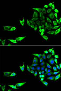 GOT1 Antibody in Immunocytochemistry (ICC/IF)