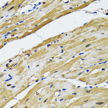 GOT1 Antibody in Immunohistochemistry (Paraffin) (IHC (P))