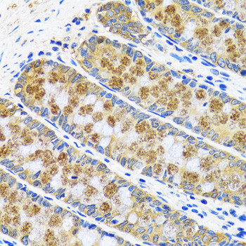 GOT1 Antibody in Immunohistochemistry (Paraffin) (IHC (P))