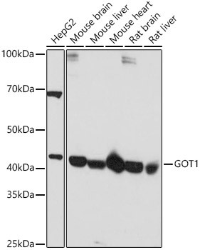 GOT1 Antibody in Western Blot (WB)