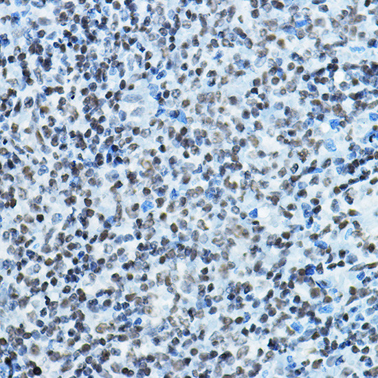 MYST2 Antibody in Immunohistochemistry (Paraffin) (IHC (P))