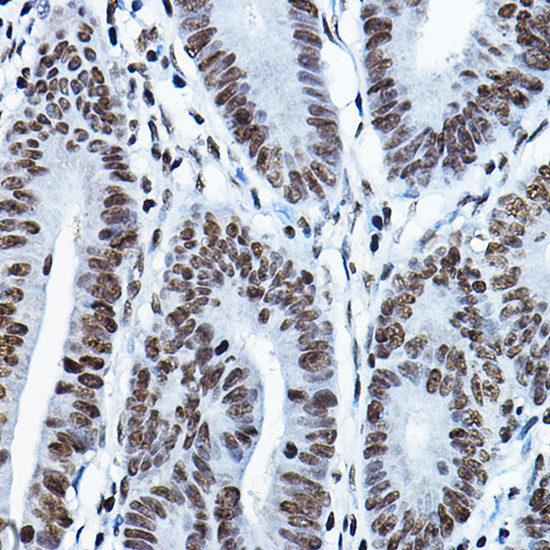 MYST2 Antibody in Immunohistochemistry (Paraffin) (IHC (P))