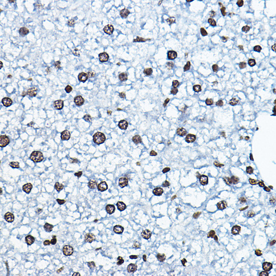 MYST2 Antibody in Immunohistochemistry (Paraffin) (IHC (P))