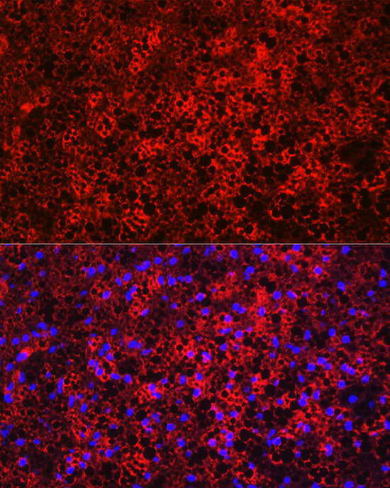 UCP1 Antibody in Immunocytochemistry (ICC/IF)