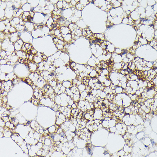 UCP1 Antibody in Immunohistochemistry (Paraffin) (IHC (P))