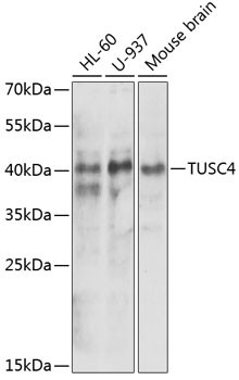 NPRL2 Antibody in Western Blot (WB)