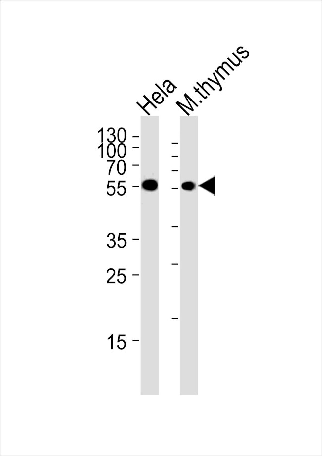 Chk1 Antibody in Western Blot (WB)