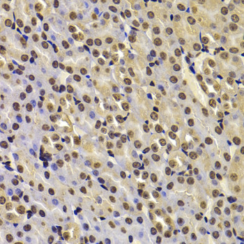 FBXW7 Antibody in Immunohistochemistry (Paraffin) (IHC (P))