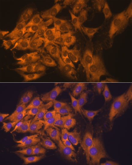 RPL17 Antibody in Immunocytochemistry (ICC/IF)