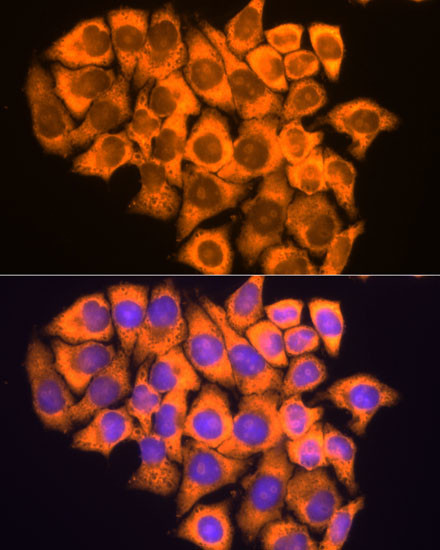 RPL17 Antibody in Immunocytochemistry (ICC/IF)