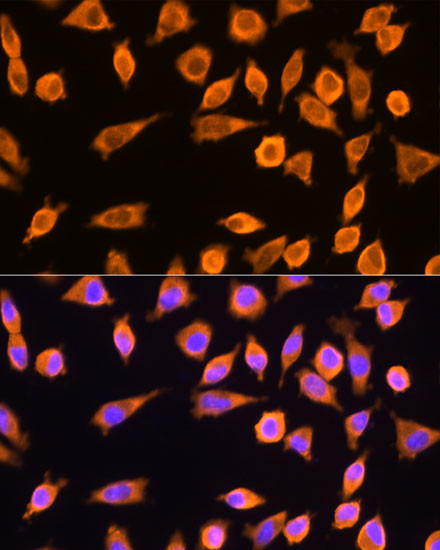 RPL17 Antibody in Immunocytochemistry (ICC/IF)