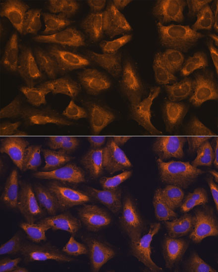 RPL17 Antibody in Immunocytochemistry (ICC/IF)