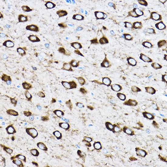 RPL17 Antibody in Immunohistochemistry (Paraffin) (IHC (P))