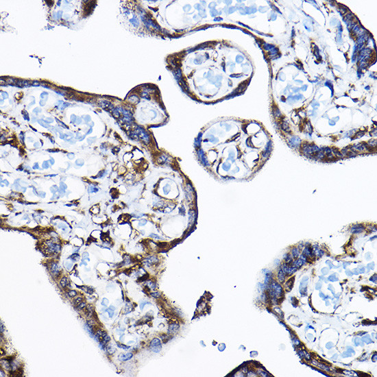 RPL17 Antibody in Immunohistochemistry (Paraffin) (IHC (P))