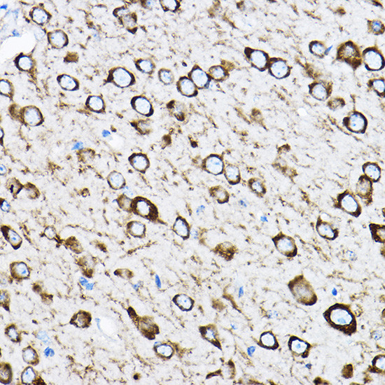 RPL17 Antibody in Immunohistochemistry (Paraffin) (IHC (P))