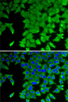 CRABP2 Antibody in Immunocytochemistry (ICC/IF)