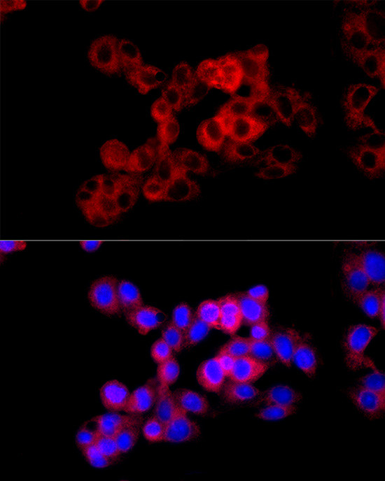 CTH Antibody in Immunocytochemistry (ICC/IF)