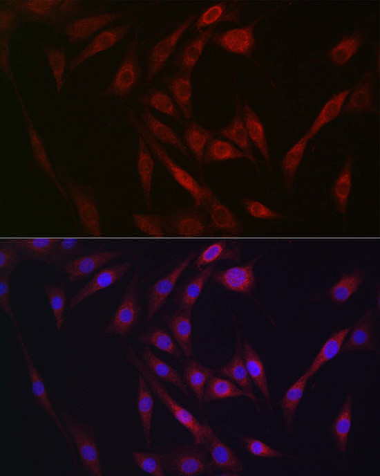 FGF23 Antibody in Immunocytochemistry (ICC/IF)