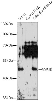 GSK3B Antibody in Immunoprecipitation (IP)