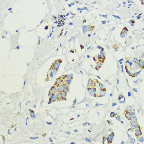 PRAS40 Antibody in Immunohistochemistry (Paraffin) (IHC (P))