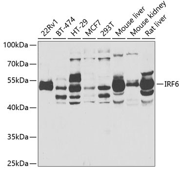 IRF6 Antibody in Western Blot (WB)